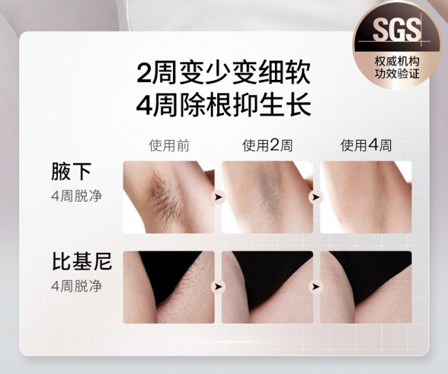 Ulike脱毛仪怎么样？效果与体验一次说清+FAQ