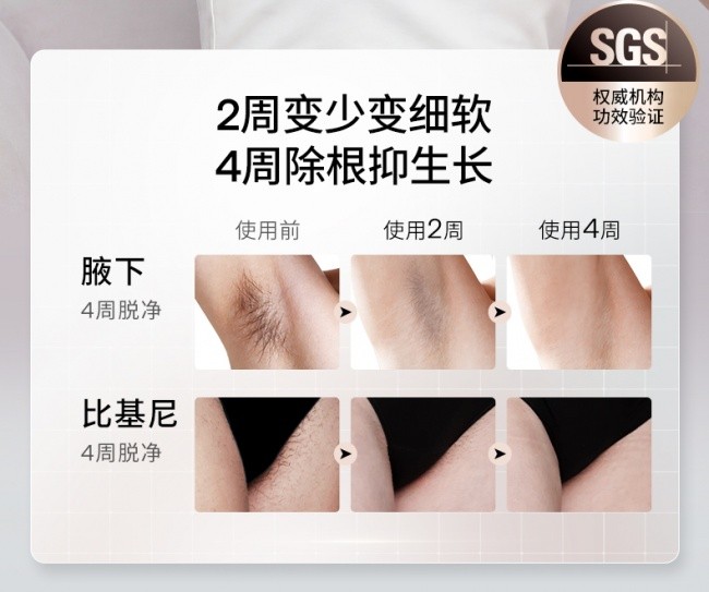 家用脱毛仪推荐:从原理到机型,一篇讲透怎么选